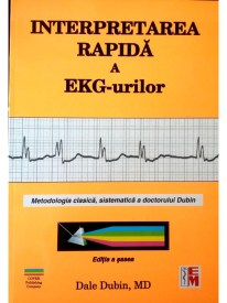 Interpretarea rapida a EKG-urilor